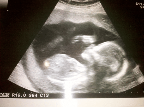 Gender Reveal.png Gender Reveal.png